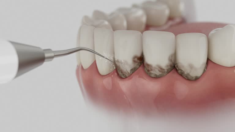 Reliable Dental contractor in Saline County County, MO by Dentist Open Now